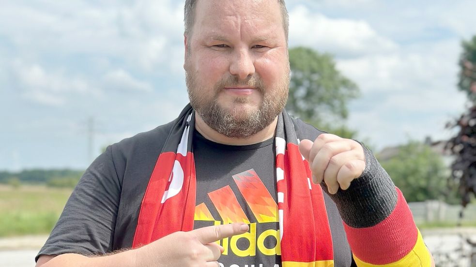 Kai Flathmann hat den Gips nun im EM-Design. Foto: Privat