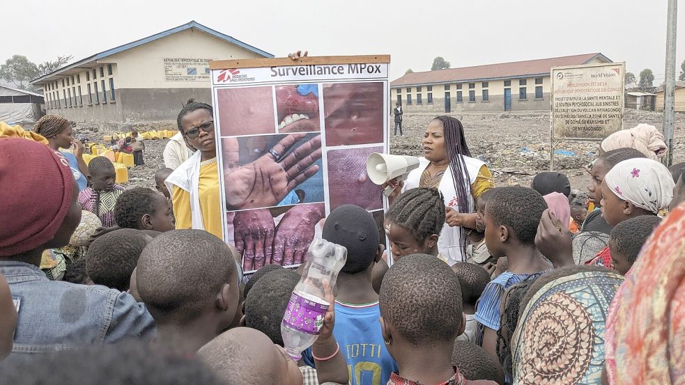 Gesundheitshelfer klären Kinder in Goma im Kongo über die Symptome der Mpox-Krankheit auf. Foto: Mudiayi/MSF/AP/dpa